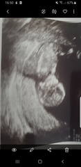 Boy or girl?
