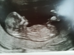 Boy or Girl?