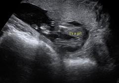 Gender scan sexing wrong?