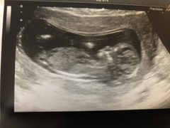 Boy or girl? Guesses please!
