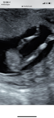 Ultrasound experts?
