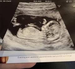 Ultrasound experts?