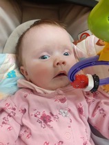 Small head/enlarged ventricles at 20 week anomaly scan - PLEASE READ