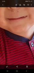 Mouth and Lips