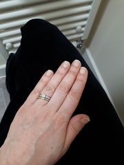 Nail biting