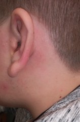 Is there anything else I can do to help DS's sore ear? He's in agony.