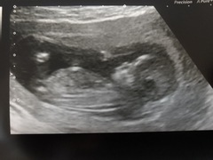 Boy or girl? Guesses please!