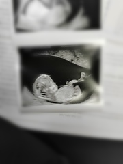 Nub theory pleaseeee 12 weeks!