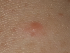 Help .....What the hell is biting me?
