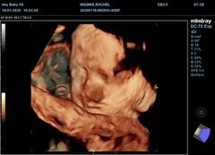 Due March 2020 - FIRST BABY in late 20's