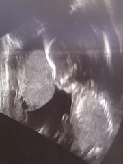 Due May 2020 (Thread 4)