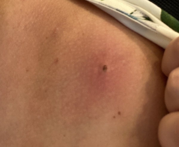 What is this lump!