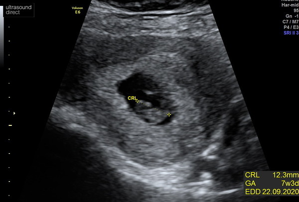 September 2020 BABIES
