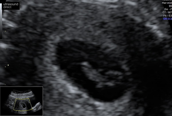 Dec19/Jan20 IVF Graduates