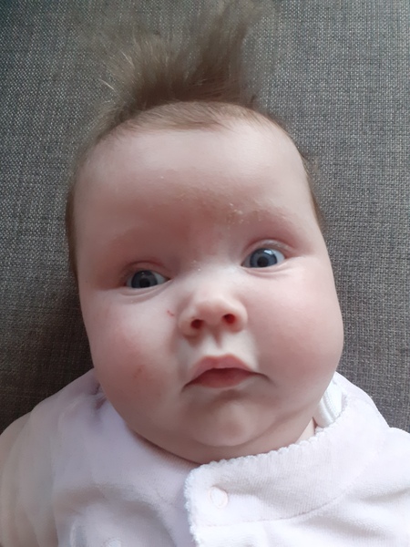 Current campaign to stop abortion of Down’s syndrome after 24 weeks scares me *Content Warning edited by MNHQ*