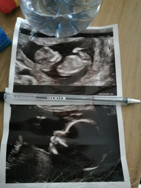 Boy or girl?