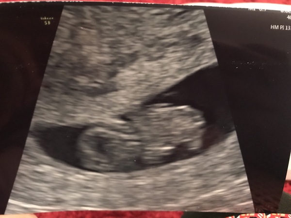 Early scan