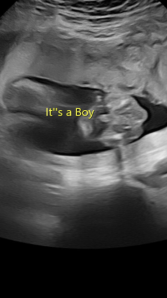 Boy scan pictures??