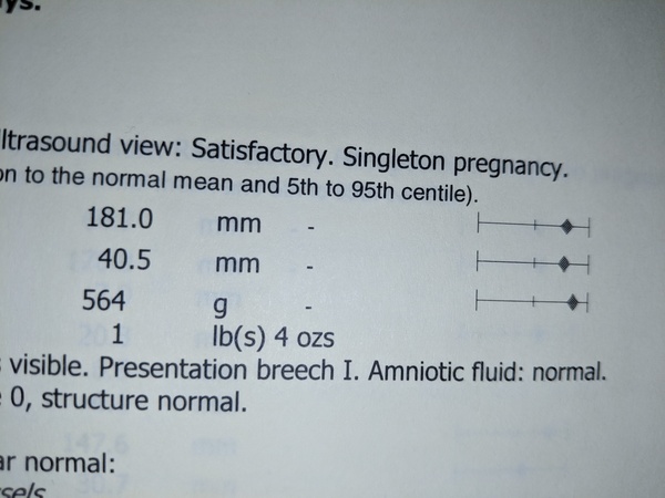 Can you explain centile to me? This is my first pregnancy