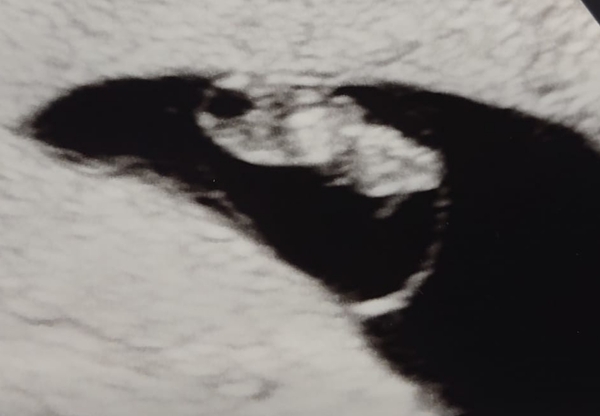 6+1/6+2 scan - Will they be able to tell me if I have miscarried?