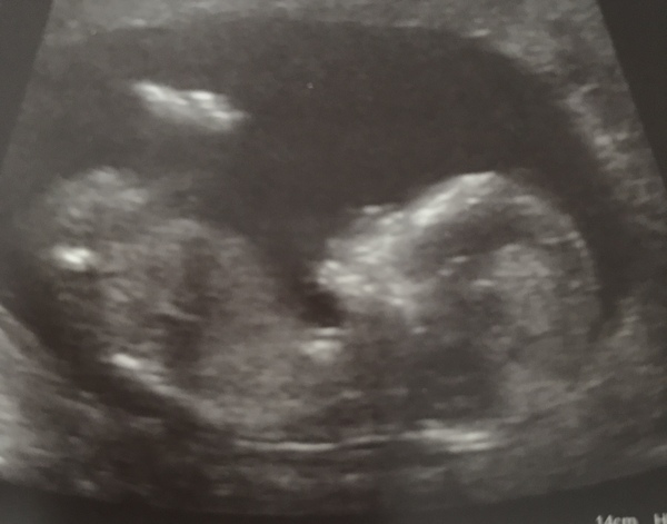 Boy or girl? 👀