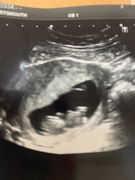 Private scan