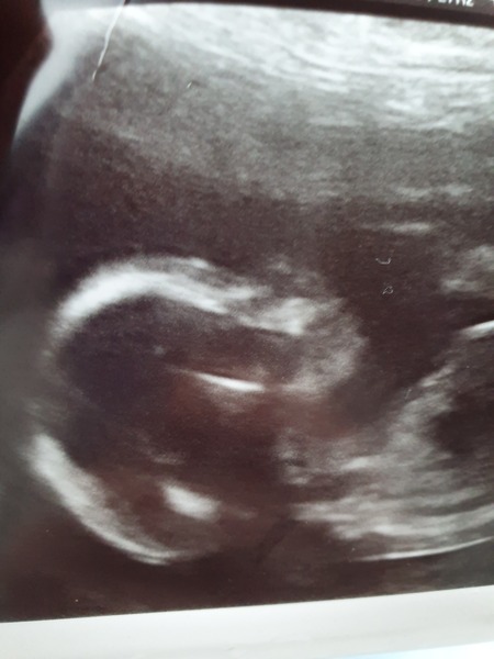 Due end of June/start of July 2020