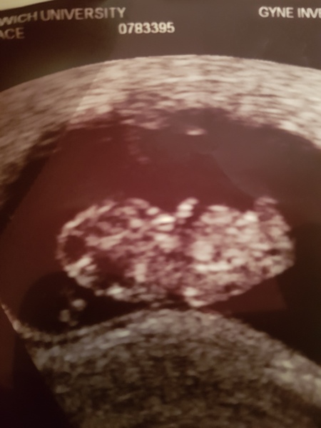 September 2020 babies?