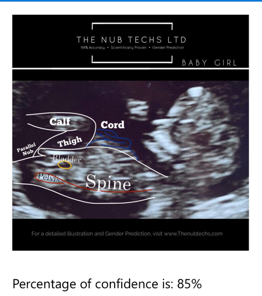 Any Sonographers (or anyone really) fancy a guess?