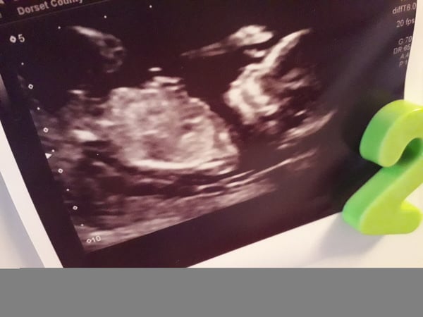 Gender confusion? Pics included.