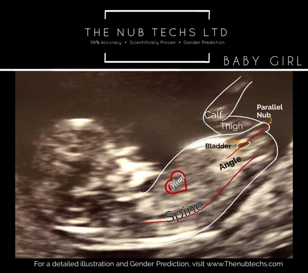 Any Sonographers (or anyone really) fancy a guess?