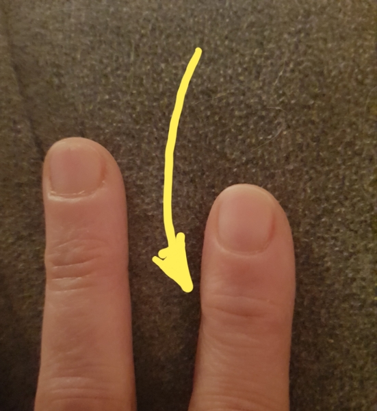 Burning, bruised type pain in knuckles...