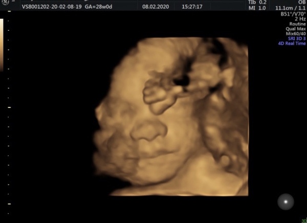 Due May 2020 (thread 5)