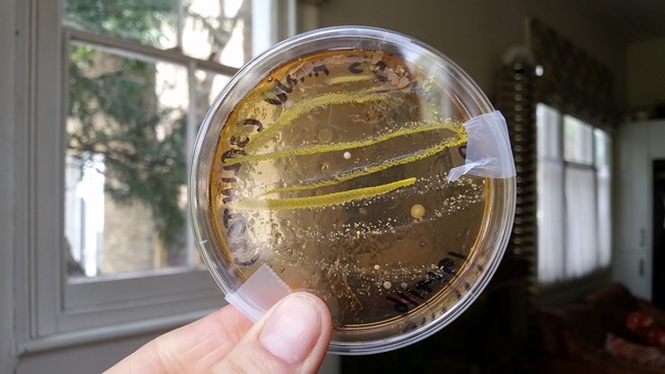 Anyone good at identifying germs on Agar plates?