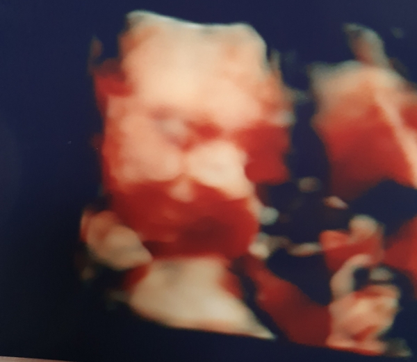 Due May 2020 (thread 5)