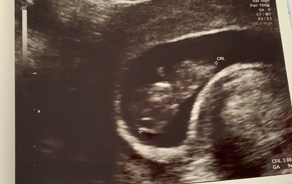September 2020 BABIES