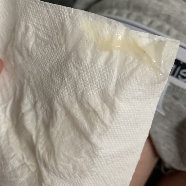 **TMI** what do you think of this mucus?