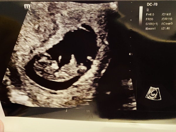 Private scan