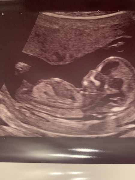 Yawn, another nub photo! I don’t understand it, any experts around?