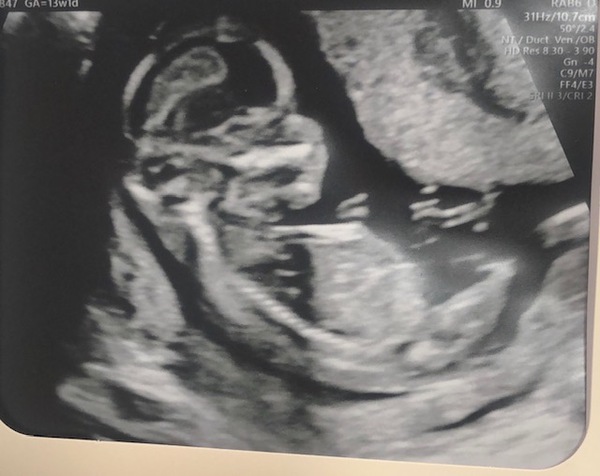 Gender Guesses!
