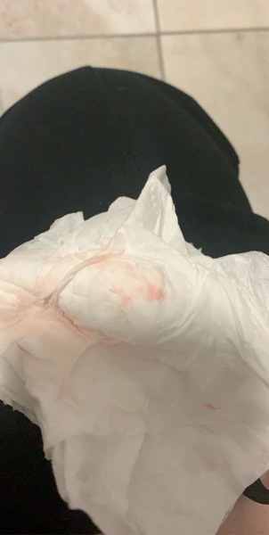 Does this look like implantation bleeding? (Sorey TMI)