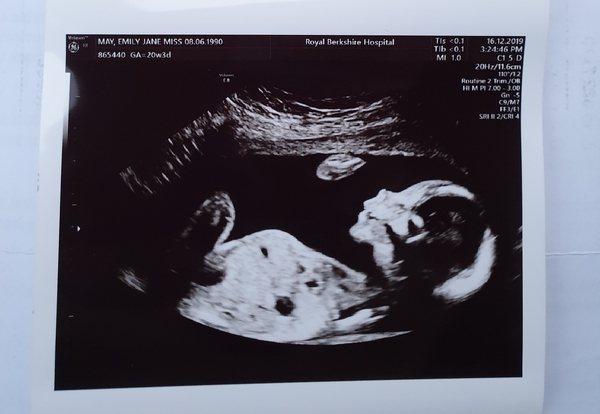 Boy scan pictures??