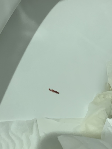 Could this be a miscarriage at 4 weeks 4 days?