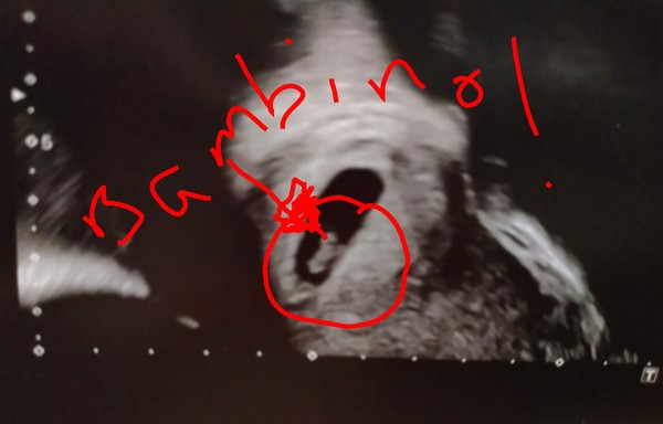 Dec19/Jan20 IVF Graduates