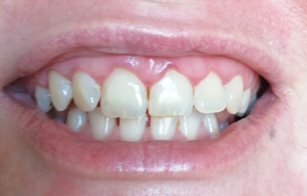 Should I change dentist?