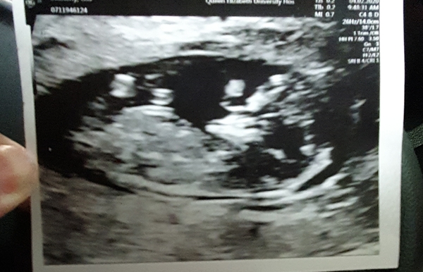 Pregnant after loss and dreaming of rainbows....