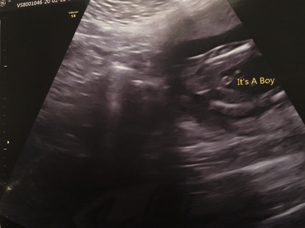 Gender confusion? Pics included.