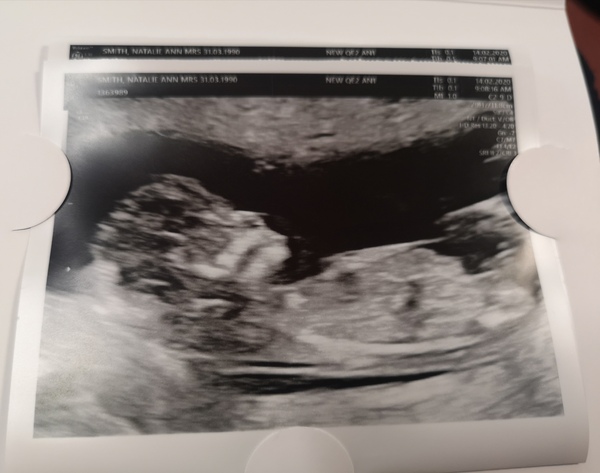 Gende guess 13 weeks
