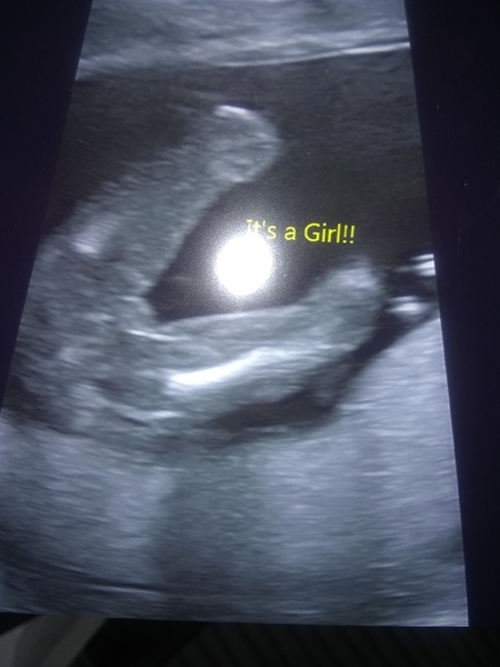 Gender confusion? Pics included.