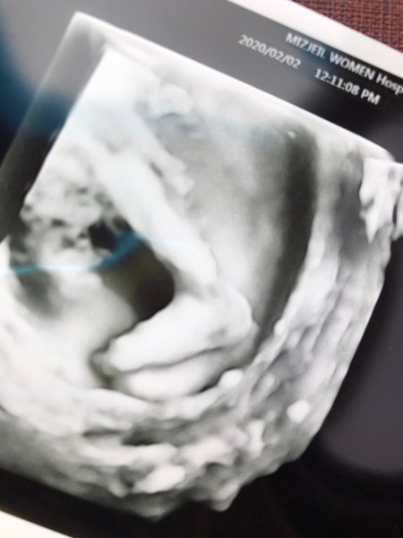 Due June 2020: Thread 4